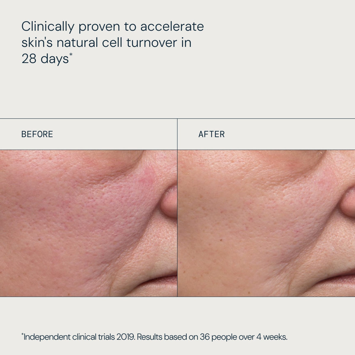 Dynamic Resurfacing Facial Pads